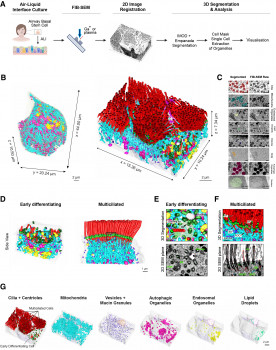 Scientists create the first 3D nanoscale maps of human airway epithelium, revealing the hidden architecture of lung defence cells Figure 1. FIB-SEM 3D reconstruction of the human airway multiciliated epithelium